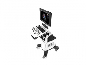 MÁY SIÊU ÂM 2D QBIT5 - CHISON medical