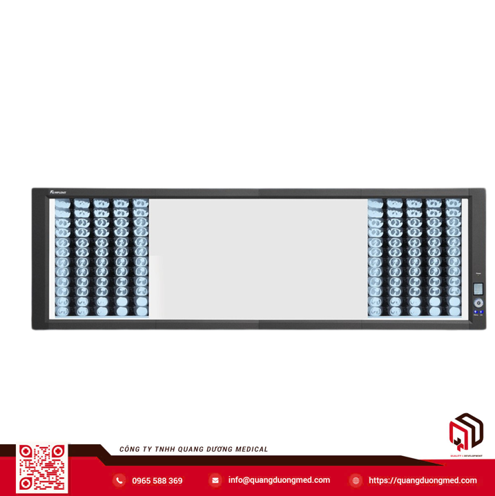 Đèn đọc phim X-quang ZG-4 - Mplent