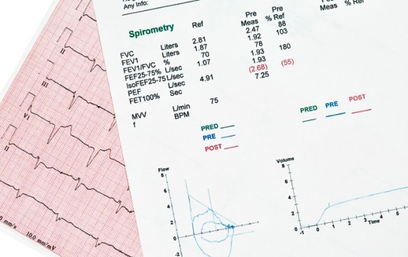 Minh hoạ kết quả đo chức năng hô hấp