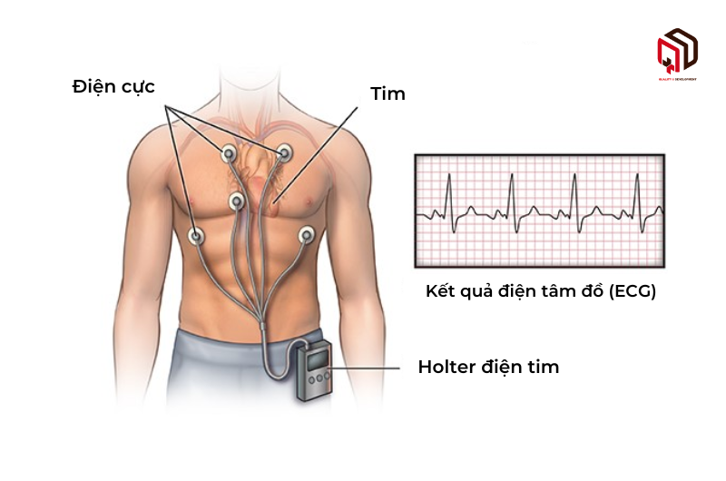 /upload/image/holter-dien-tim-3.png