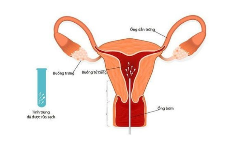 /upload/image/iui-la-gi-3.png