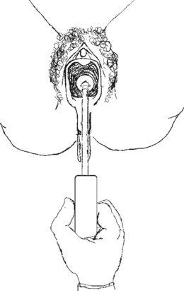 /upload/image/may-ap-lanh-co-tu-cung-mc120.png