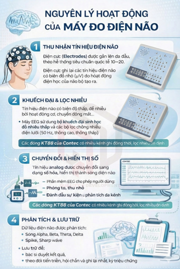 /upload/image/nguyen-ly-hoat-dong-cua-may-do-dien-nao-eeg.png
